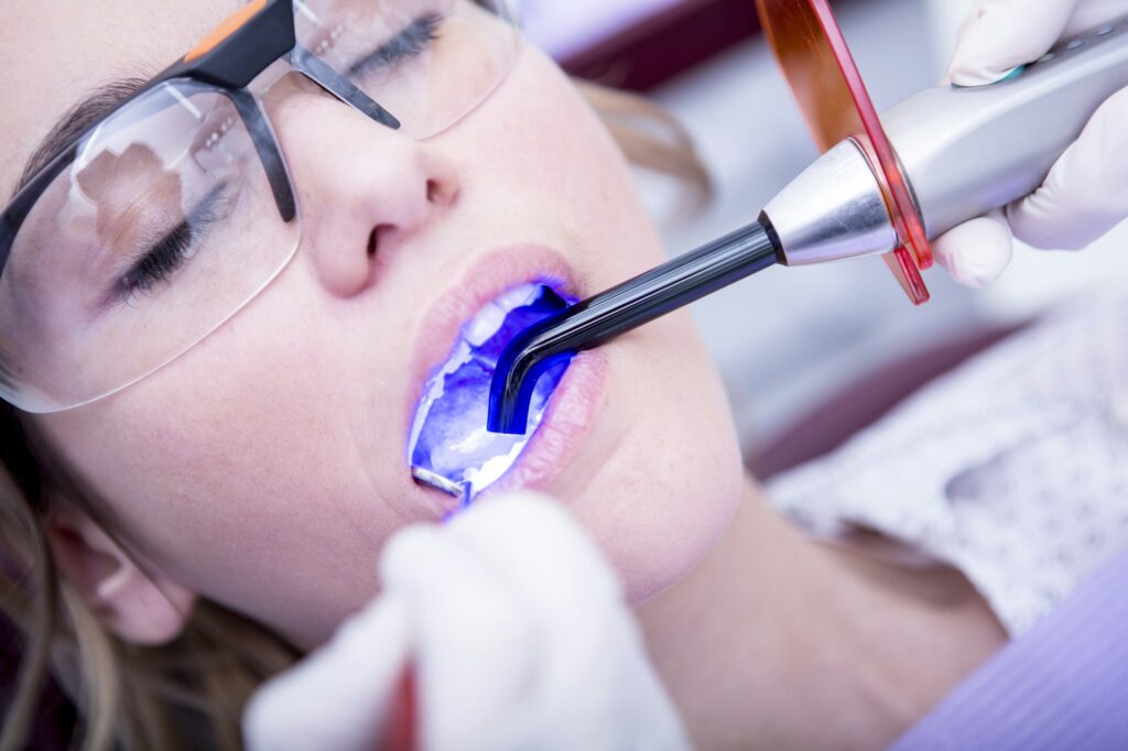 Hardening of dental filling at the dentist