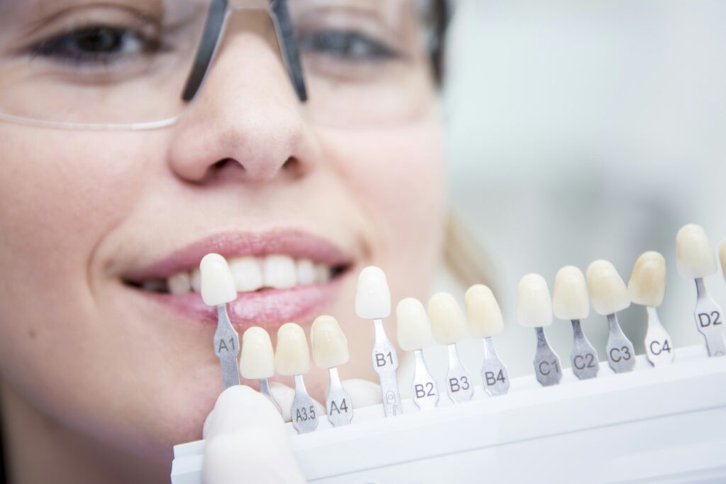 Woman at the dentist choosing color for teeth whitening